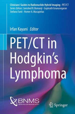 PET/CT in Hodgkin’s Lymphoma de Irfan Kayani