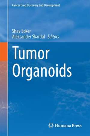 Tumor Organoids de Shay Soker