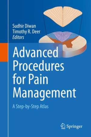 Advanced Procedures for Pain Management: A Step-by-Step Atlas de Sudhir Diwan