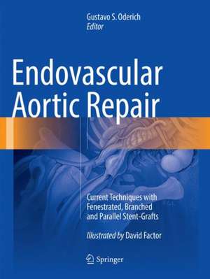 Endovascular Aortic Repair: Current Techniques with Fenestrated, Branched and Parallel Stent-Grafts de Gustavo S. Oderich