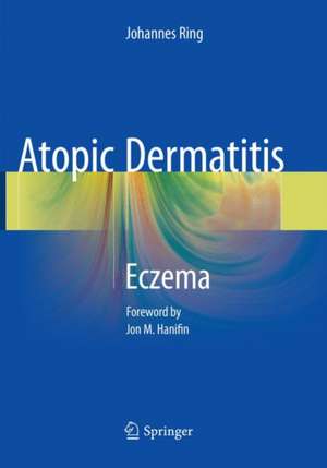 Atopic Dermatitis: Eczema de Johannes Ring