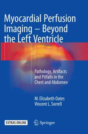 Myocardial Perfusion Imaging - Beyond the Left Ventricle: Pathology, Artifacts and Pitfalls in the Chest and Abdomen de M. Elizabeth Oates