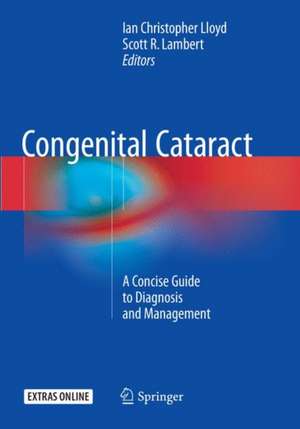 Congenital Cataract: A Concise Guide to Diagnosis and Management de Ian Christopher Lloyd