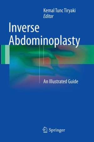 Inverse Abdominoplasty: An Illustrated Guide de Kemal Tunc Tiryaki