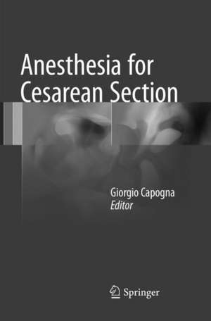 Anesthesia for Cesarean Section de Giorgio Capogna