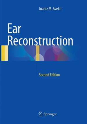 Ear Reconstruction de Juarez M. Avelar