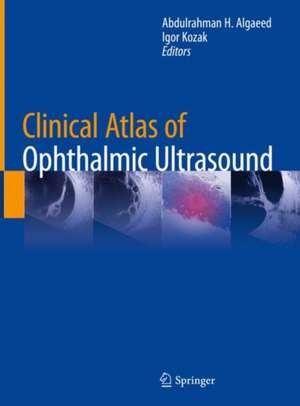 Clinical Atlas of Ophthalmic Ultrasound de Abdulrahman H. Algaeed