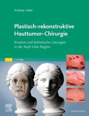 Plastisch-rekonstruktive Hauttumor-Chirurgie de Andreas Lösler