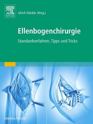 Ellenbogenchirurgie: Atlas zu Standardverfahren, Tipps und Tricks de Ulrich Stöckle