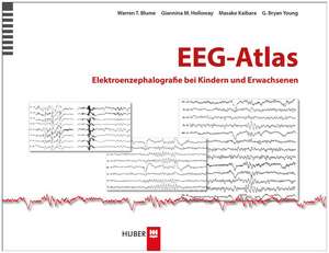 EEG-Atlas de Warren T. Blume