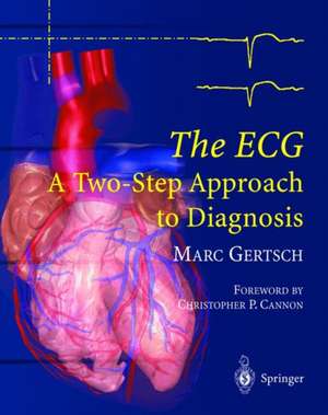 The ECG: A Two-Step Approach to Diagnosis de Marc Gertsch