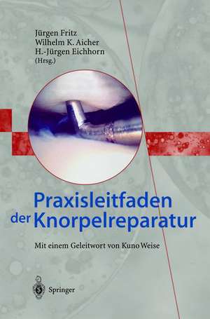 Praxisleitfaden der Knorpelreparatur de Jürgen Fritz