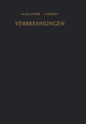 Verbrennungen: Pathophysiologie · Pathologie · Klinik · Therapie de M. Allgöwer