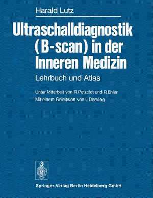 Ultraschalldiagnostik (B-scan) in der Inneren Medizin: Lehrbuch und Atlas de L. Demling