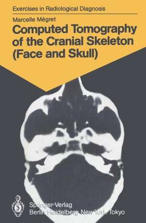 Computed Tomography of the Cranial Skeleton (Face and Skull): 58 Radiological Exercises for Students and Practitioners de Marcelle Megret