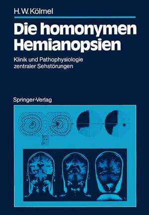 Die homonymen Hemianopsien: Klinik und Pathophysiologie zentraler Sehstörungen de Hans W. Kölmel