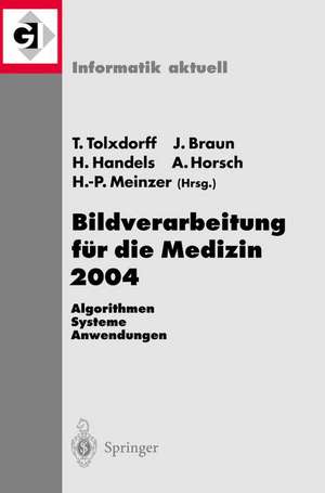 Bildverarbeitung für die Medizin 2004: Algorithmen - Systeme - Anwendungen de Thomas Tolxdorff