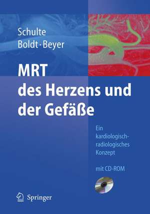 MRT des Herzens und der Gefäße: Indikationen - Strategien - Abläufe - Ergebnisse de B. Schulte