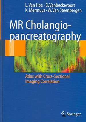 MR Cholangiopancreatography: Atlas with Cross-Sectional Imaging Correlation de L. van Hoe