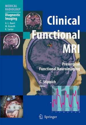 Clinical Functional MRI: Presurgical Functional Neuroimaging de K. Sartor