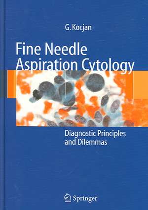 Fine Needle Aspiration Cytology: Diagnostic Principles and Dilemmas de Gabrijela Kocjan