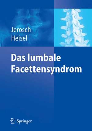 Das lumbale Facettensyndrom de Jörg Jerosch