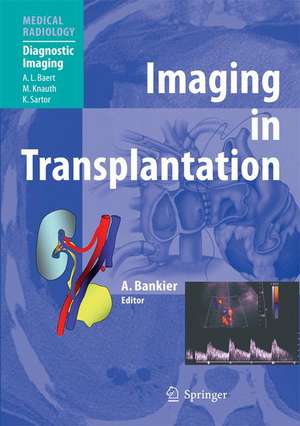 Imaging in Transplantation de Alexander A. Bankier