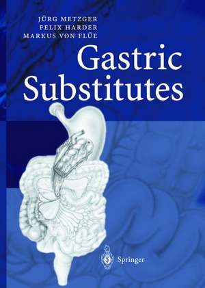 Gastric Substitutes de Jürg Metzger