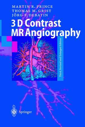 3D Contrast MR Angiography de Martin R. Prince