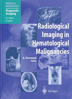 Radiological Imaging in Hematological Malignancies de R.A. Castellino