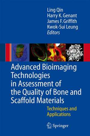 Advanced Bioimaging Technologies in Assessment of the Quality of Bone and Scaffold Materials: Techniques and Applications de L. Qin