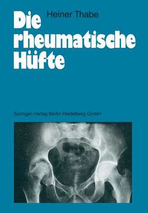 Die rheumatische Hüfte de Heiner Thabe