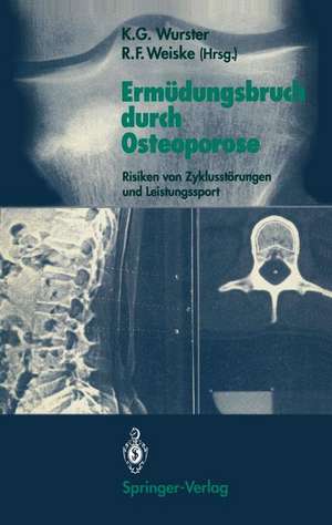 Ermüdungsbruch durch Osteoporose: Risiken von Zyklusstörungen und Leistungssport de Kurt G. Wurster