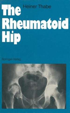 The Rheumatoid Hip de Heiner Thabe