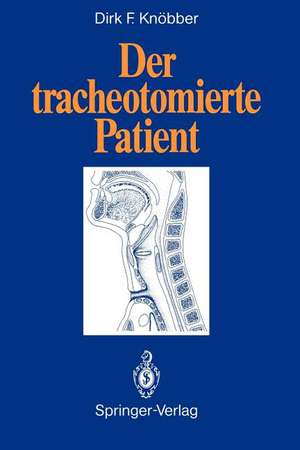 Der tracheotomierte Patient de Dirk F. Knöbber