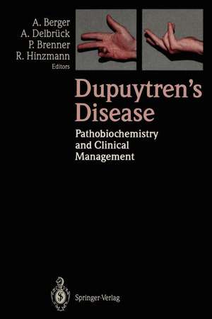 Dupuytren’s Disease: Pathobiochemistry and Clinical Management de Alfred Berger