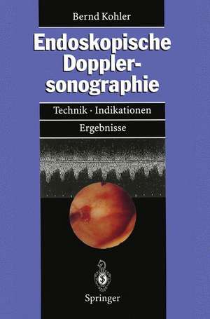 Endoskopische Dopplersonographie: Technik · Indikationen · Ergebnisse de Bernd M. Kohler