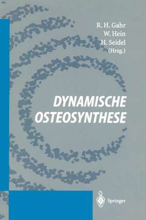 Dynamische Osteosynthese de R. H. Gahr