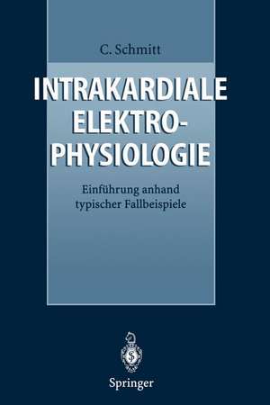 Intrakardiale Elektrophysiologie: Einführung anhand typischer Fallbeispiele de Claus Schmitt