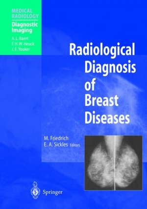 Radiological Diagnosis of Breast Diseases de Michael Friedrich