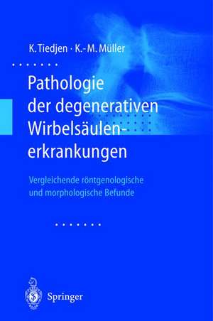 Pathologie der degenerativen Wirbelsäulenerkrankungen: Vergleichende röntgenologische und morphologische Befunde de Kay Tiedjen