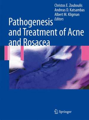 Pathogenesis and Treatment of Acne and Rosacea de Christos C. Zouboulis