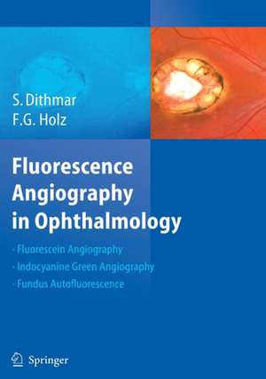 Fluorescence Angiography in Ophthalmology de Stefan Dithmar