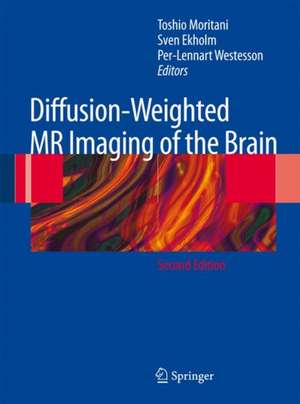 Diffusion-Weighted MR Imaging of the Brain de Toshio Moritani