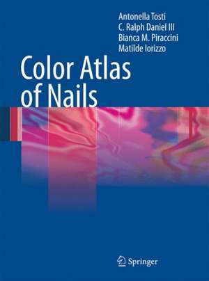 Color Atlas of Nails de Antonella Tosti