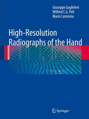 High-Resolution Radiographs of the Hand de Giuseppe Guglielmi