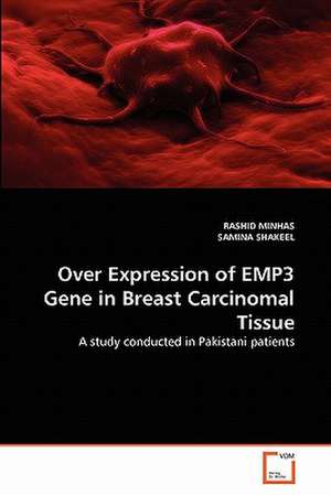 Over Expression of Emp3 Gene in Breast Carcinomal Tissue