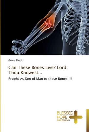 Can These Bones Live? Lord, Thou Knowest... de Ababio Grace