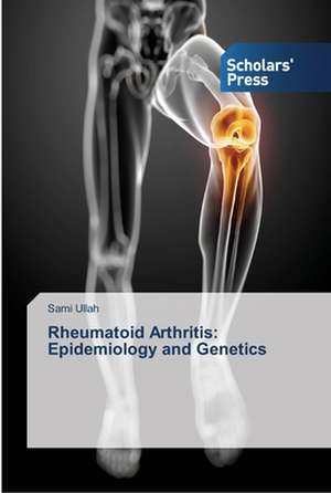 Rheumatoid Arthritis: Epidemiology and Genetics de Sami Ullah