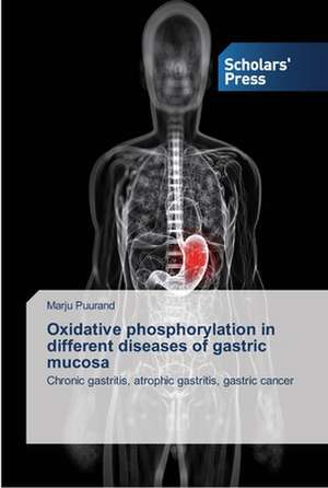 Oxidative phosphorylation in different diseases of gastric mucosa de Marju Puurand